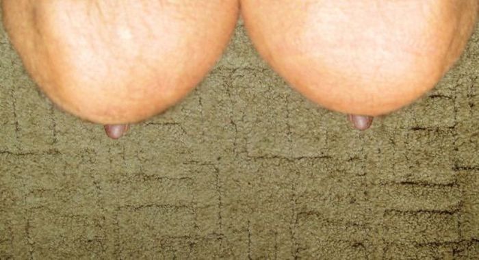 s (5)