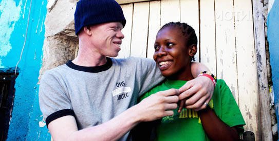 FBL-TANZANIA-ALBINOS