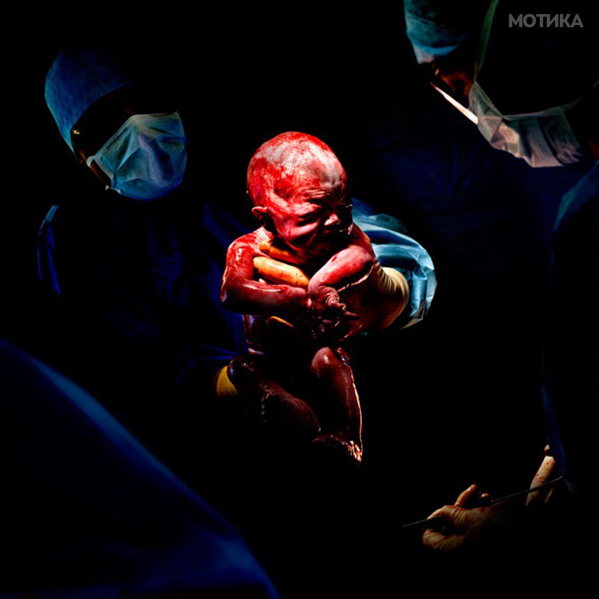 newborn-infant-photos-c-section-cesar-christian-berthelot-10