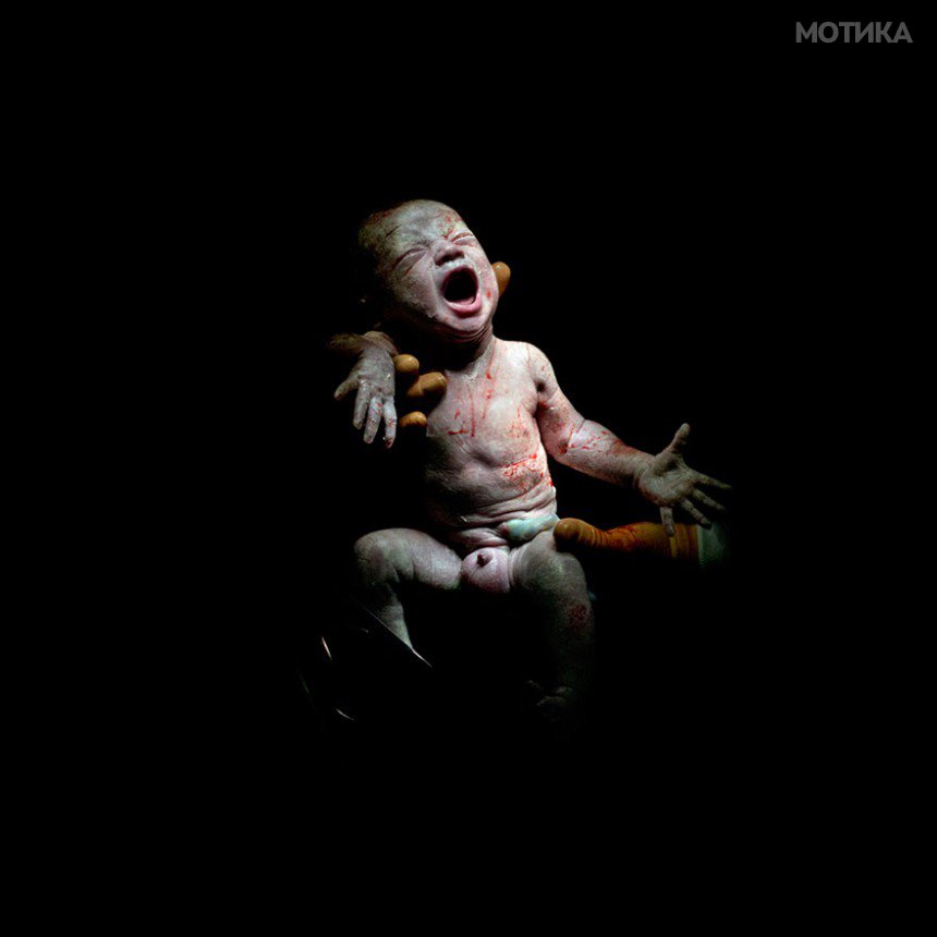 newborn-infant-photos-c-section-cesar-christian-berthelot-3