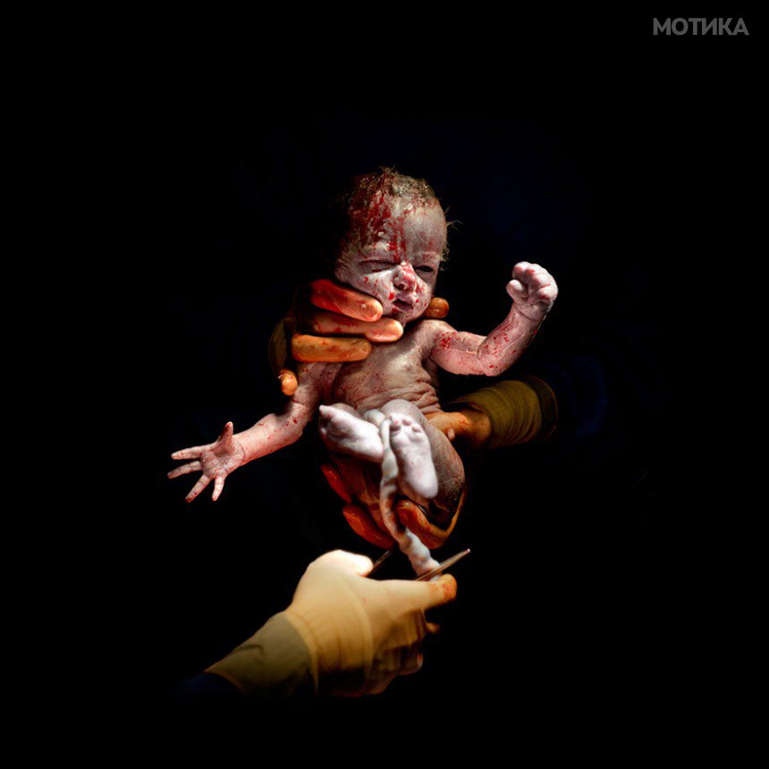 newborn-infant-photos-c-section-cesar-christian-berthelot-7