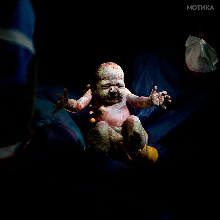 newborn-infant-photos-c-section-cesar-christian-berthelot-8
