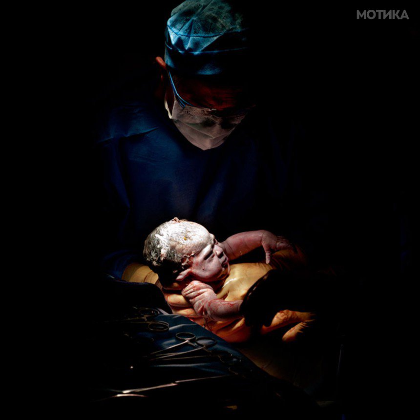 newborn-infant-photos-c-section-cesar-christian-berthelot-9